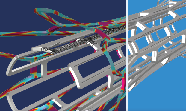 Modéliser les dispositifs médicaux avec COMSOL Multiphysics®