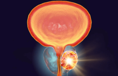 KOELIS dévoile au Congrès Français d’Urologie 2024 les premiers résultats intermédiaires de l’étude VIOLETTE